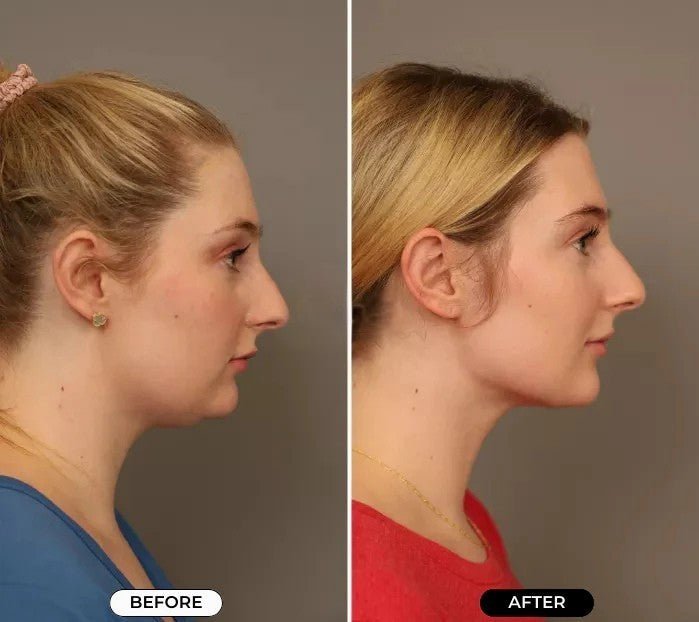 FlexFace™ | 4 in 1 Gesichtsmassagegerät - Finezo.de