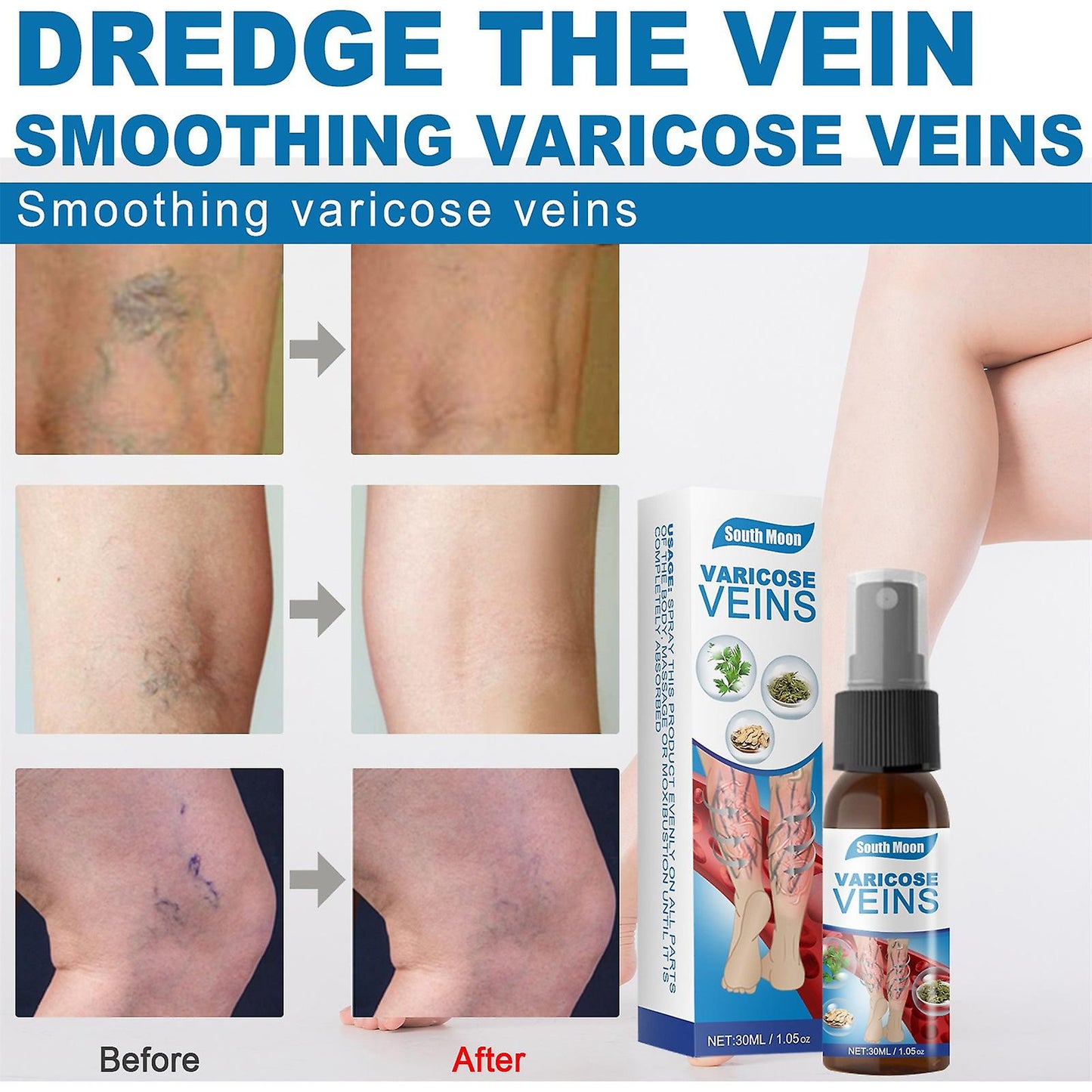 Magische Venen - Spray | 1+1 GRATIS - Finezo.de