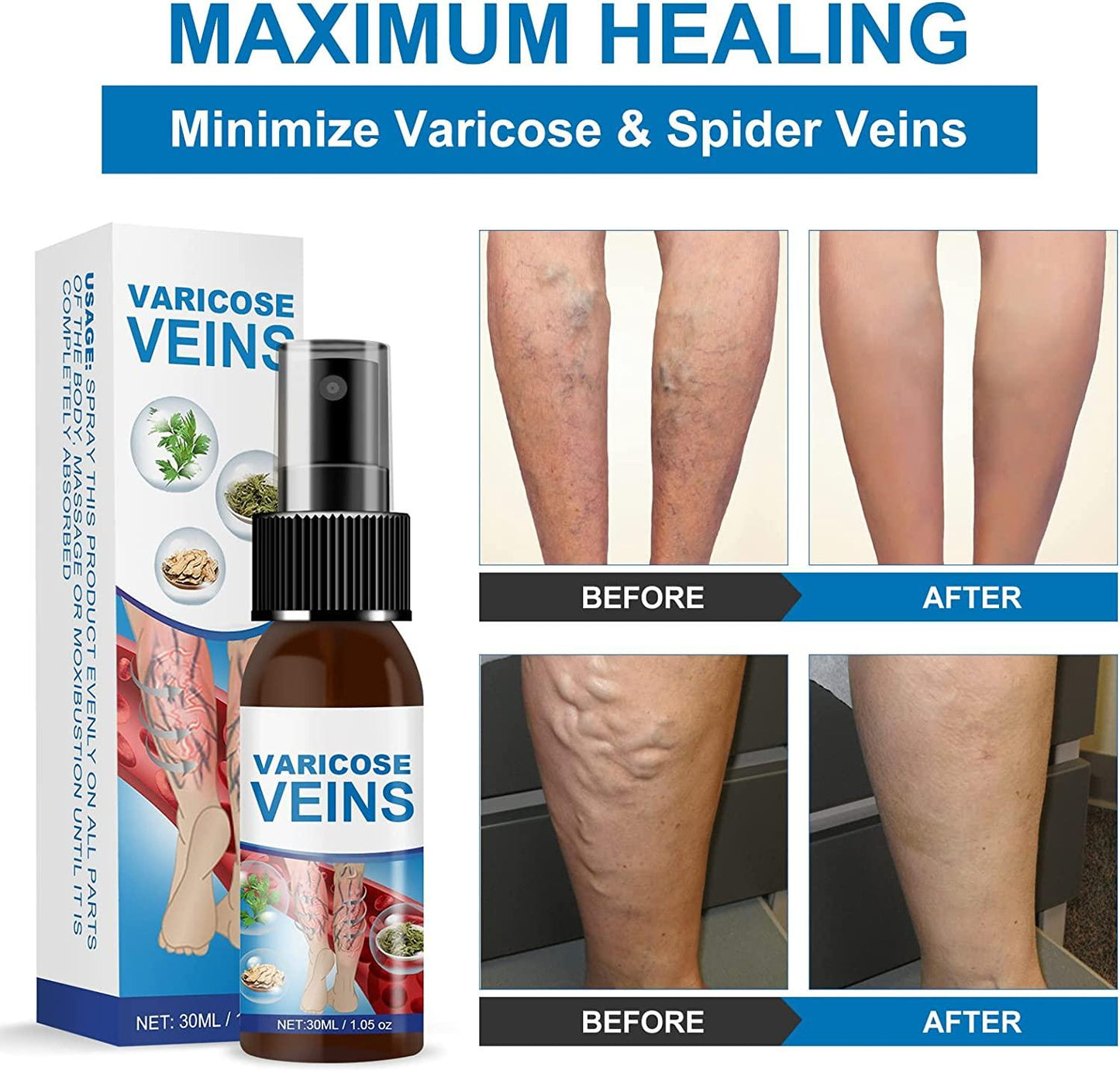Magische Venen - Spray | 1+1 GRATIS - Finezo.de