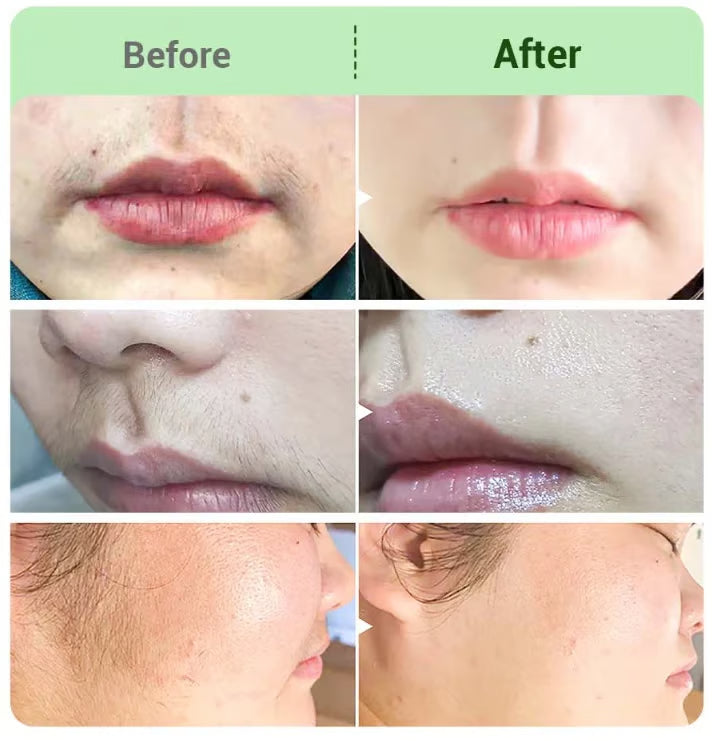 Schmerzlostes Haarentfernung Creme Set für Damen