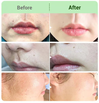 Schmerzlostes Haarentfernung Creme Set für Damen