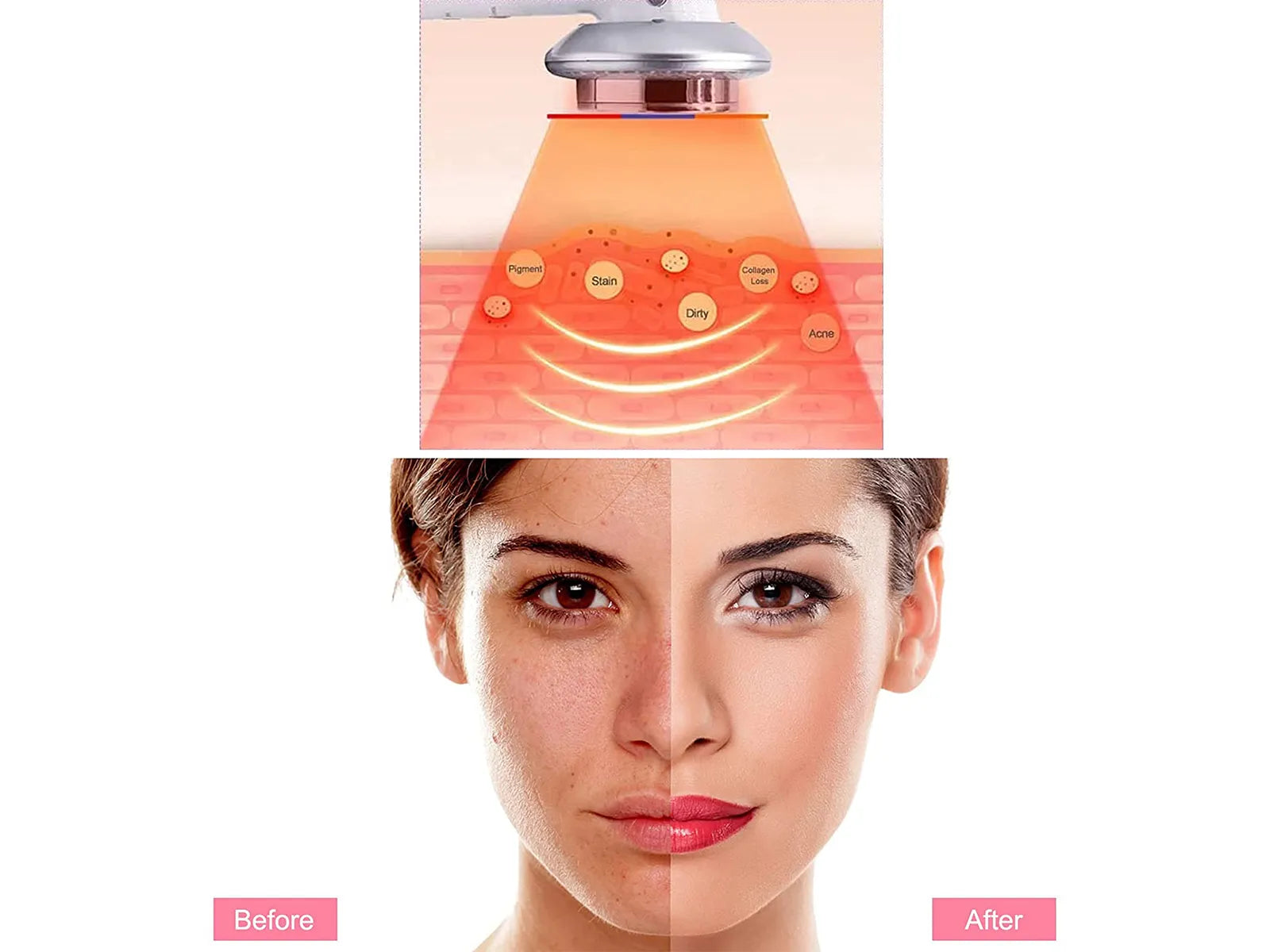 LipoWave™ | Ultraschall-Vet- & Celluliteverbrenner | 50% RABATT