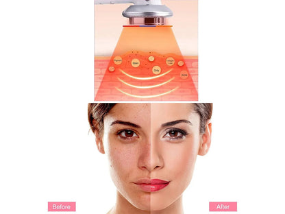 LipoWave™ | Ultraschall - Vet - & Celluliteverbrenner | 50% RABATT - Finezo.de