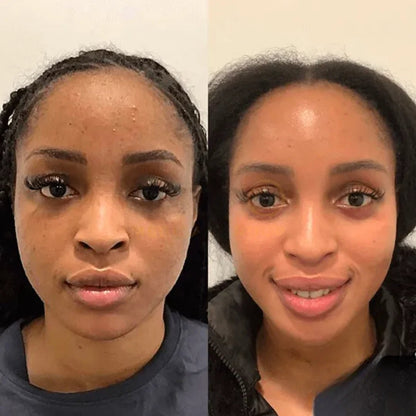 Finezo Collagen Nachtmaske - 1+1 GRATIS - Finezo.de