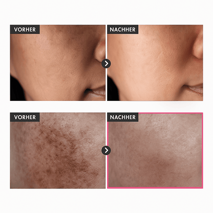 Finezo Koreanische Aufhellungscreme - Finezo.de