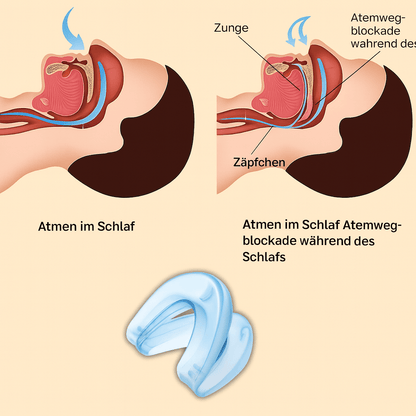 FineRest™ | SchlafGut Schnarchstopper - Finezo.de