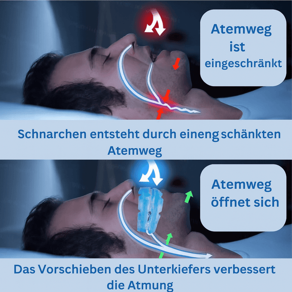 SchlafGut Schnarchstopper