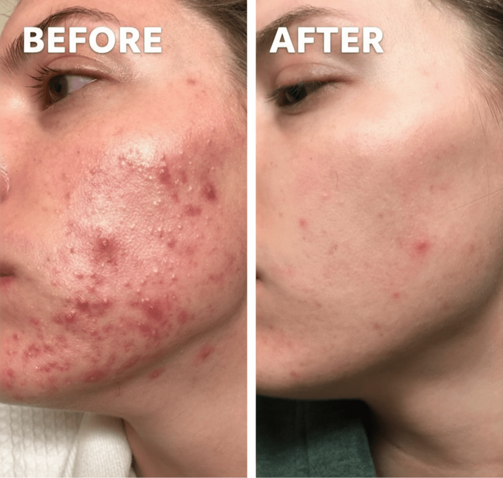 Glow Brush™ | Für strahlend schöne Haut jeden Tag - Finezo.de