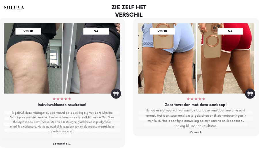 DermaCup™ | Anti - Cellulite - Straffungsmassage - Finezo.de