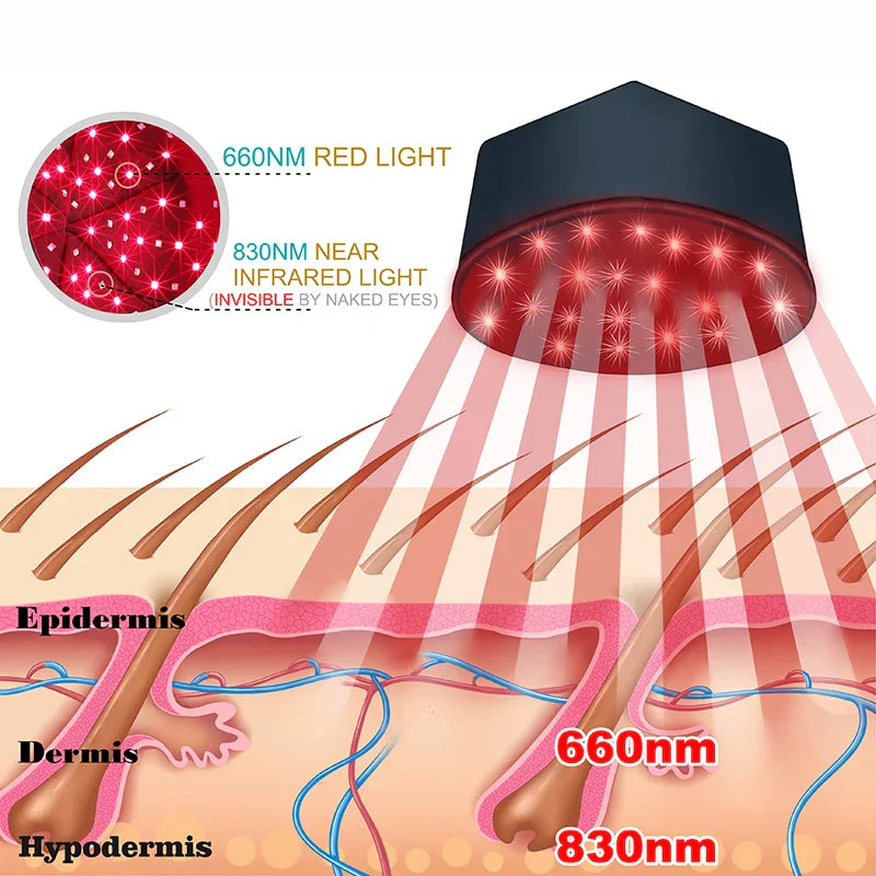 GrowHat™ | Red Light Hair Growth Cap | 50% RABATT