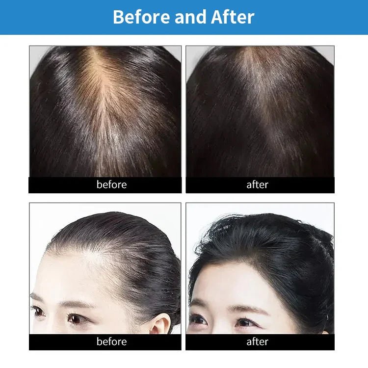 GrowHat™ | Red Light Hair Growth Cap | 50% RABATT - Finezo.de