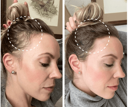 Hairflow™ | Elektrische Massagebürste + Kostenloses Geschenk - Finezo.de