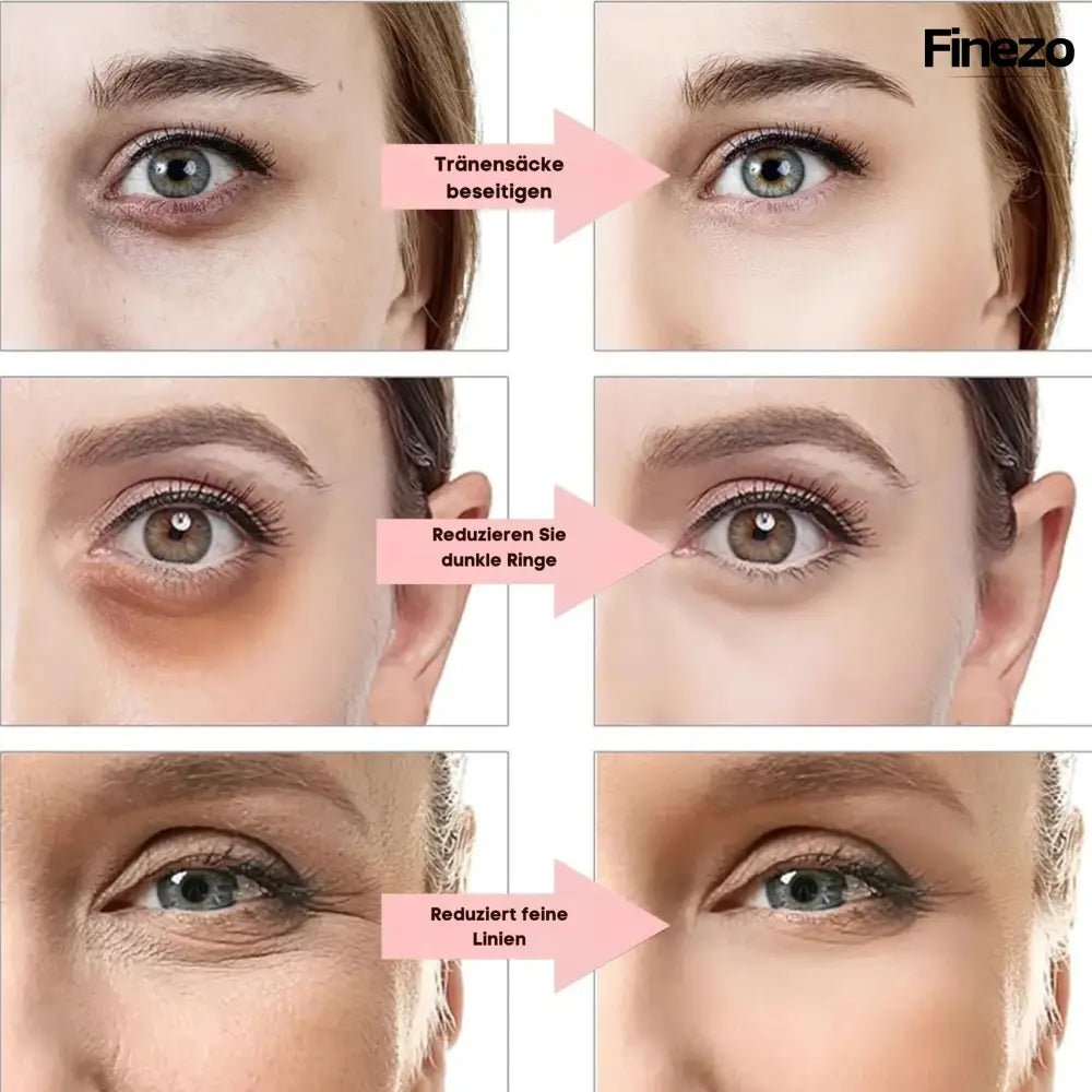 Glameyes™ | Augenrevitalizer – Für strahlende, wache Augen ohne Augenringe! | 50% RABATT - Finezo.de