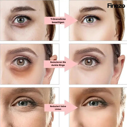 Glameyes™ | Augenrevitalizer – Für strahlende, wache Augen ohne Augenringe! | 50% RABATT - Finezo.de