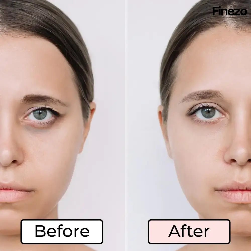 Glameyes™ | Augenrevitalizer – Für strahlende, wache Augen ohne Augenringe! | 50% RABATT - Finezo.de