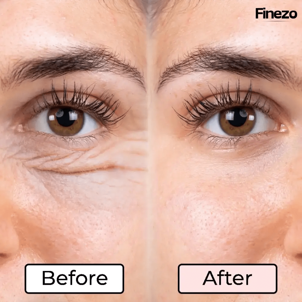 Glameyes™ | Augenrevitalizer – Für strahlende, wache Augen ohne Augenringe! | 50% RABATT - Finezo.de