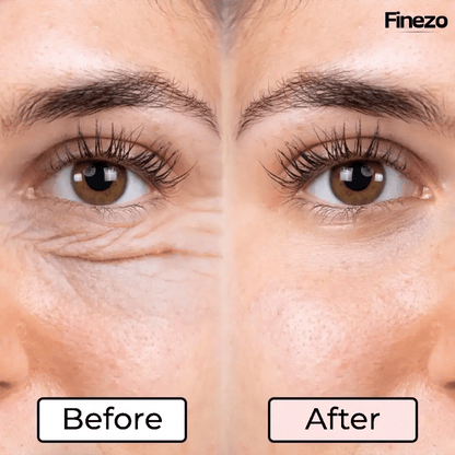 Glameyes™ | Augenrevitalizer – Für strahlende, wache Augen ohne Augenringe! | 50% RABATT - Finezo.de