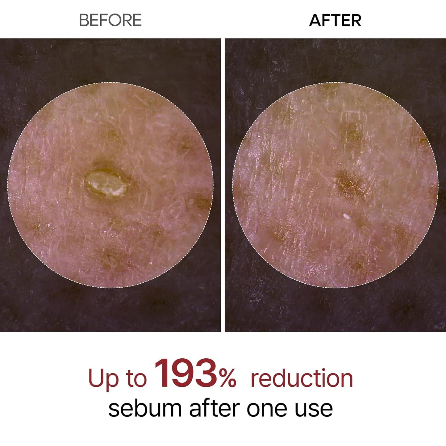PeelShot™ | Strahlendes Hautwunder Serum - 1+1 GRATIS