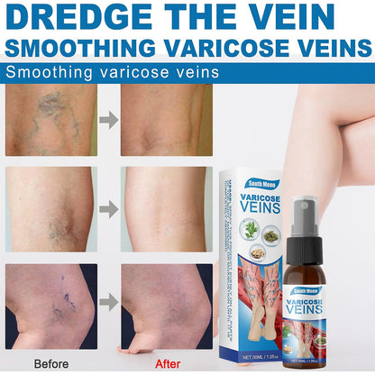 Magische Venen - Spray | 1+1 GRATIS - Finezo.de