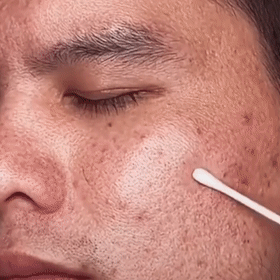 Grüner Tee Gesichtsmaske Stick