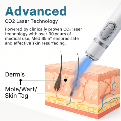 SkinPro™ | Hautfreundlicher Laserstift
