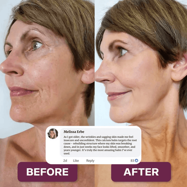 Calcium - Multibalsam | 1+1 GRATIS - Finezo.de