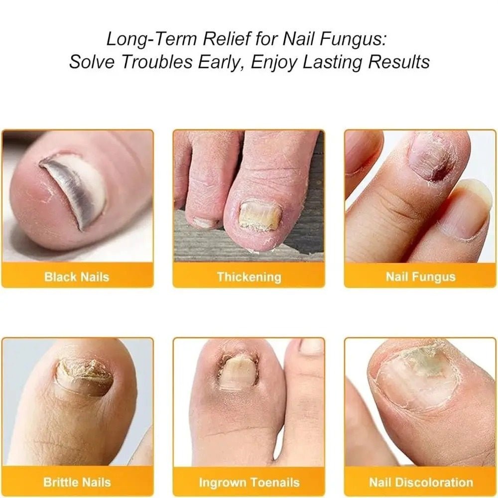 NailPatch™ | Nagelpflege Wunderpflaster - 1+2 GRATIS - Finezo.de