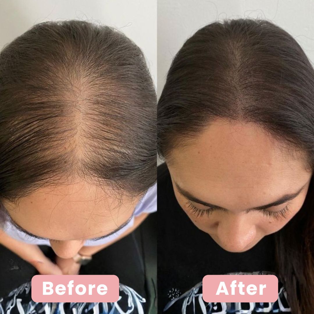 Luminé | 4 in 1 Haarauffrischungsbürste - Finezo.de