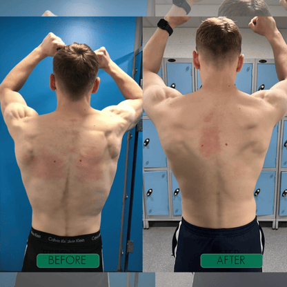 Haltungshelfer für Damen - Finezo.de