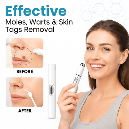 SkinPro™ | Hautfreundlicher Laserstift