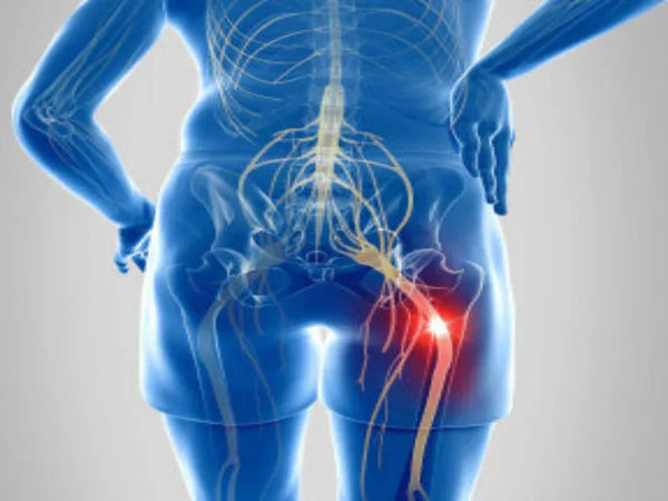 Finezo Schmerzfrei Gürtel