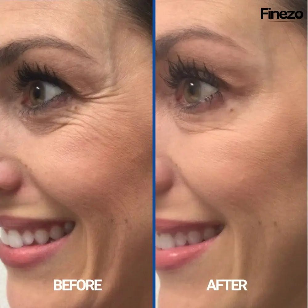 SilkTech™ | Falten sicher beseitigen | 1+2 GRATIS - Finezo.de