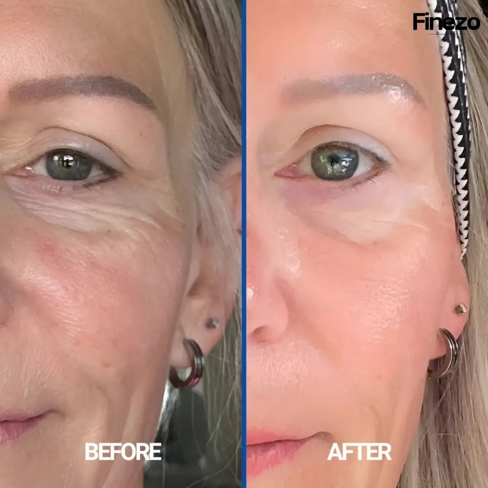 SilkTech™ | Falten sicher beseitigen | 1+2 GRATIS - Finezo.de