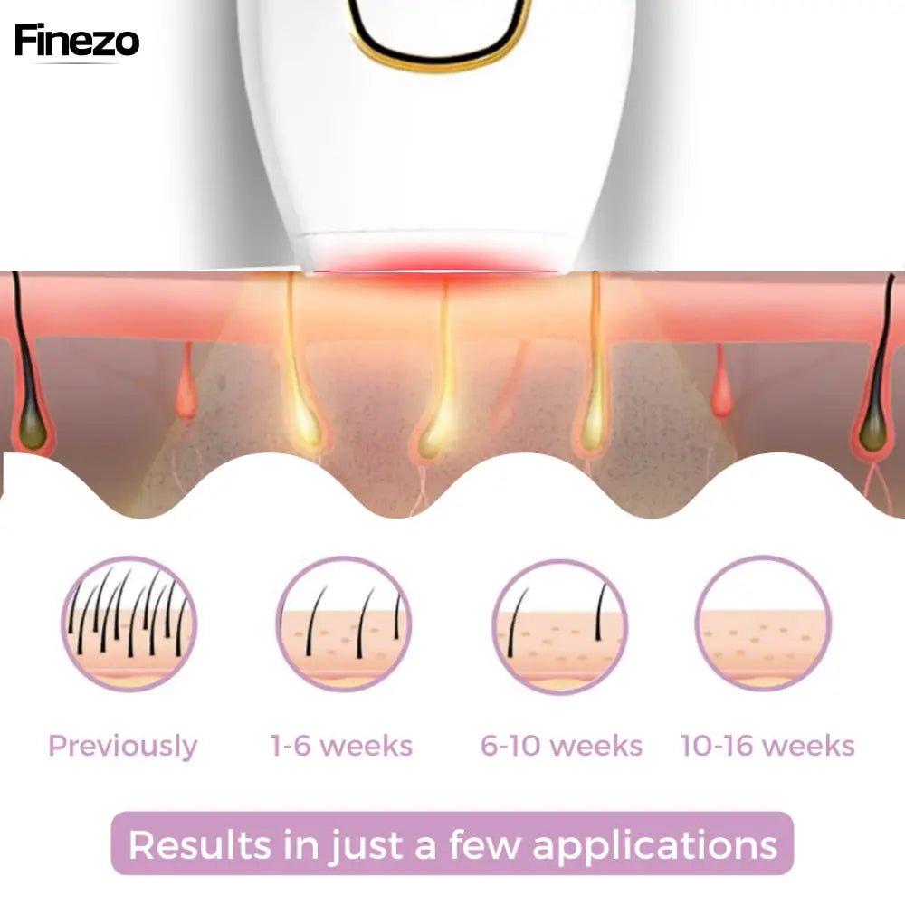 Velaira™ | Schmerzfreie Haarentfernung | 50% RABATT - Finezo.de