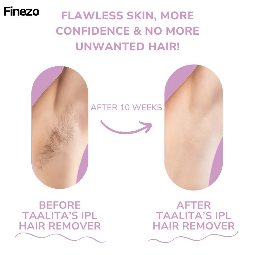 Velaira™ | Schmerzfreie Haarentfernung | 50% RABATT - Finezo.de